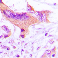 NIP1 Rabbit Polyclonal Antibody