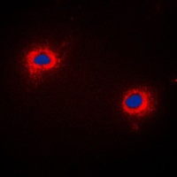 NIP1 Rabbit Polyclonal Antibody