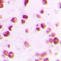 Artemis (Phospho-S516) Antibody