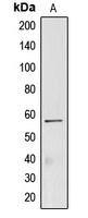 CREB3L2 Rabbit Polyclonal Antibody