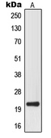 MRPL32 Rabbit Polyclonal Antibody