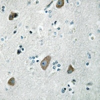 MRPL32 Rabbit Polyclonal Antibody