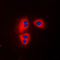 MRPL32 Rabbit Polyclonal Antibody