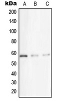 STK33 Rabbit Polyclonal Antibody