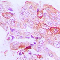 STK33 Rabbit Polyclonal Antibody