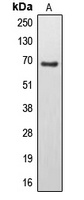 EPS8L3 Rabbit Polyclonal Antibody