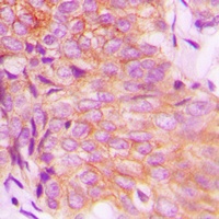 EPS8L3 Rabbit Polyclonal Antibody