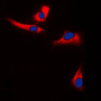 EPS8L3 Rabbit Polyclonal Antibody