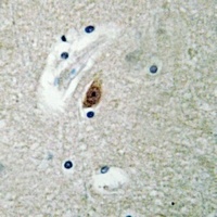 LASS4 Rabbit Polyclonal Antibody