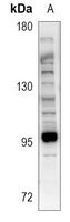 Microcephalin Antibody