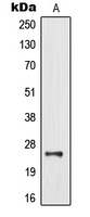 MOB3B Rabbit Polyclonal Antibody
