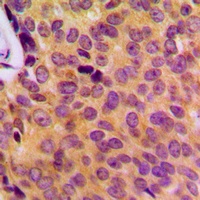 MOB3B Rabbit Polyclonal Antibody