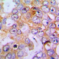 Collagen 18 alpha 1 Antibody