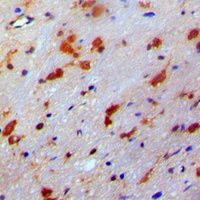 PDRG1 Rabbit Polyclonal Antibody