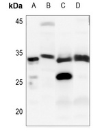 DNAL1 Rabbit Polyclonal Antibody