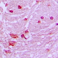 DNAL1 Rabbit Polyclonal Antibody