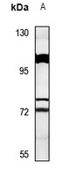 SYT16 Rabbit Polyclonal Antibody