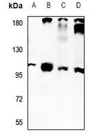 NaBC1 Rabbit Polyclonal Antibody