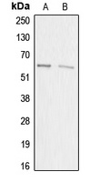 ACRBP Rabbit Polyclonal Antibody