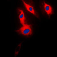 ACRBP Rabbit Polyclonal Antibody