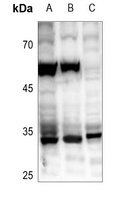 ZC3H8 Rabbit Polyclonal Antibody