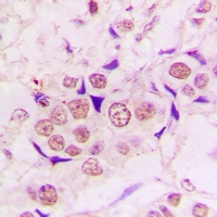ZC3H8 Rabbit Polyclonal Antibody