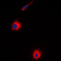 USP30 Rabbit Polyclonal Antibody