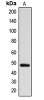 ARRDC1 Rabbit Polyclonal Antibody
