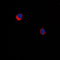 ARRDC1 Rabbit Polyclonal Antibody