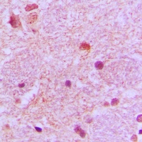 TP53INP1 Rabbit Polyclonal Antibody
