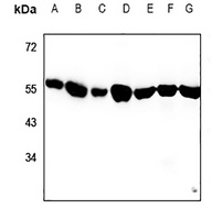 Alpha-tubulin 3C/D/E Rabbit Polyclonal Antibody