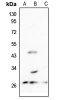 MRPL10 Rabbit Polyclonal Antibody