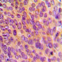 MRPL10 Rabbit Polyclonal Antibody