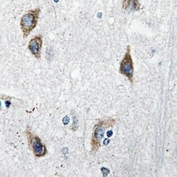Neuromedin S Antibody