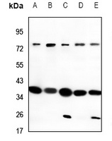 CD200R Rabbit Polyclonal Antibody