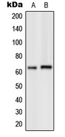 GPK7 Rabbit Polyclonal Antibody
