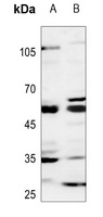 GCNT7 Rabbit Polyclonal Antibody