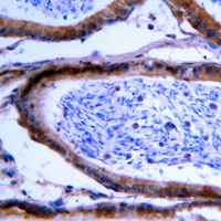GCNT7 Rabbit Polyclonal Antibody