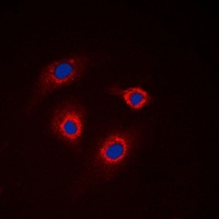 GCNT7 Rabbit Polyclonal Antibody