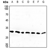 Cerebellin 4 Rabbit Polyclonal Antibody