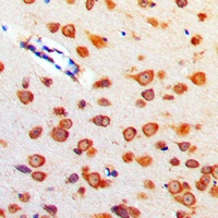 Cerebellin 4 Rabbit Polyclonal Antibody