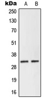 NEURL2 Rabbit Polyclonal Antibody