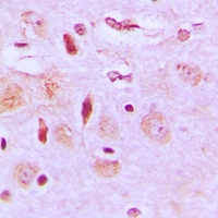 NEURL2 Rabbit Polyclonal Antibody