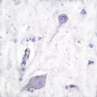 CD172a Rabbit Polyclonal Antibody
