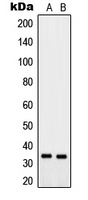 PTGR2 Rabbit Polyclonal Antibody