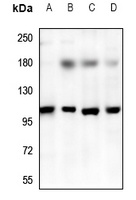TRPV3 Antibody