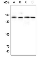 GPR125 Rabbit Polyclonal Antibody