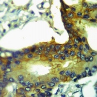 GPR125 Rabbit Polyclonal Antibody