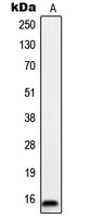 ORAOV1 Rabbit Polyclonal Antibody