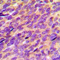 ORAOV1 Rabbit Polyclonal Antibody